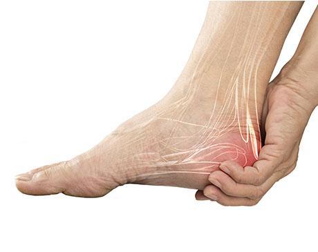 Lower Extremity Nerve Pain Conditions